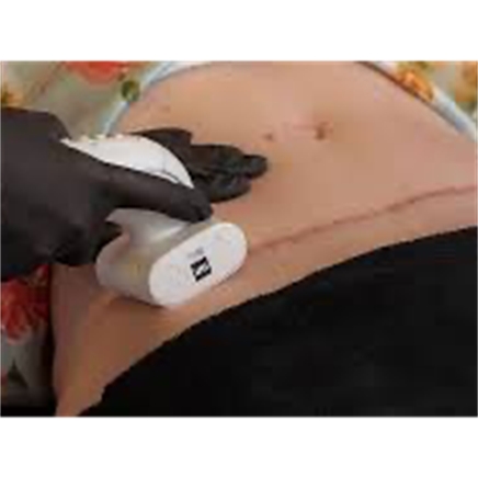 LPG Endermologie & Medical Endermologie – herstel, versteviging en natuurlijke regeneratie