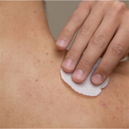 Zuiverende Acne Rugbehandeling met Combi Peeling & LED-therapie