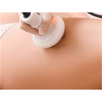 Vetverwijderende Body Cavitatie Therapie & LPG