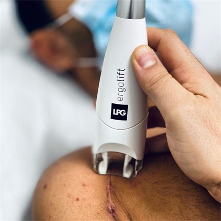 LPG Body Endermologie littekenbehandeling